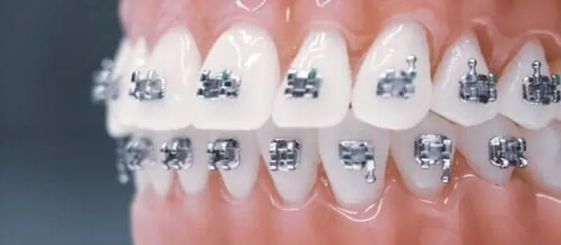 Przygotowanie do zmiany drutu w aparacie